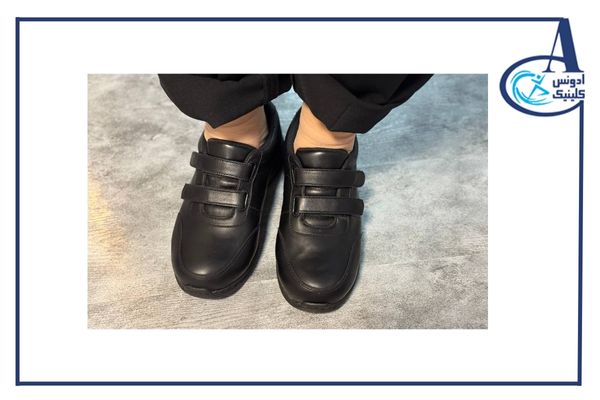 کفش پای دیابتی-ادونس کلینیک